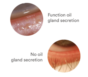 Gland secretion